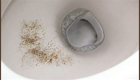 Mold in toilet bowl. Things To Know About Mold in toilet bowl. 